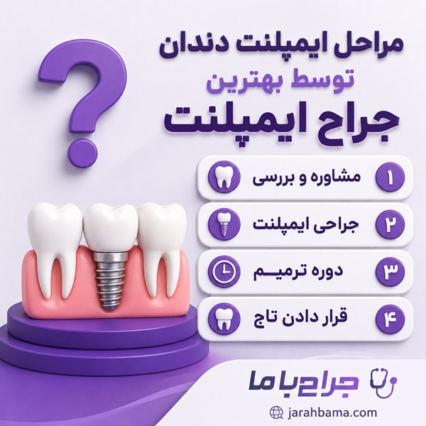 خدمات بهترین جراح ایمپلنت در تهران