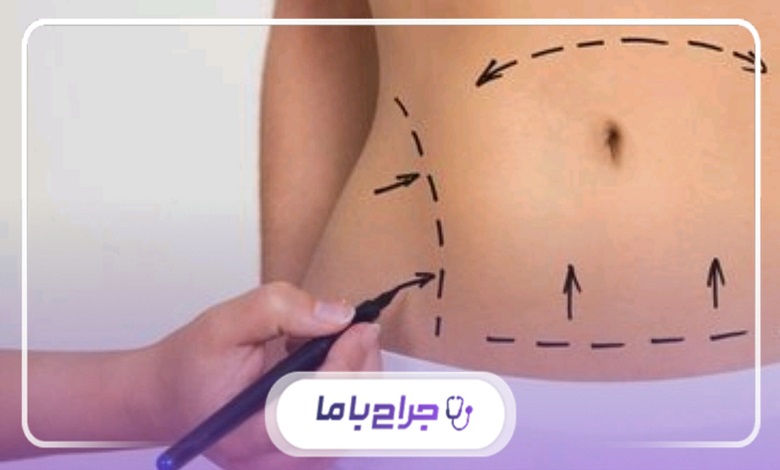 اشتباهات رایج هنگام انتخاب بهترین کلینیک لاغری بدون جراحی در اندیشه