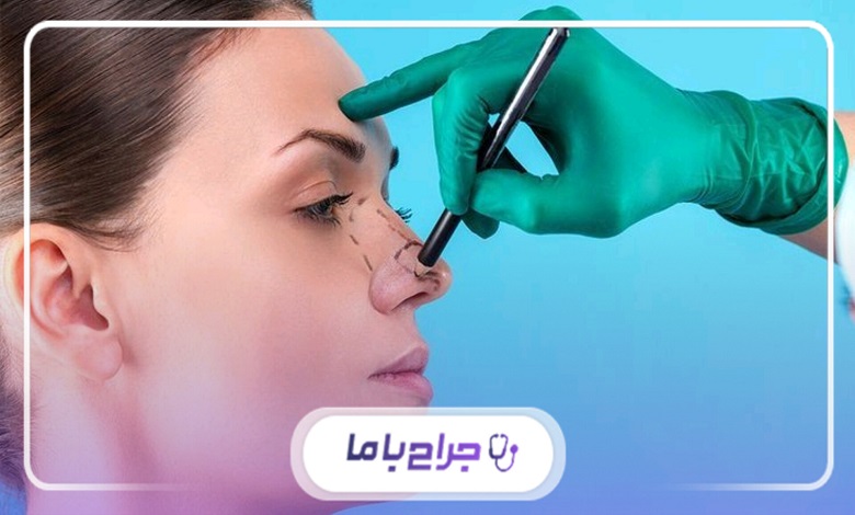 اشتباهات رایج در انتخاب بهترین جراح بینی گوشتی در شیراز