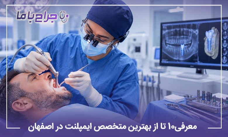 معرفی10 تا از بهترین متخصص ایمپلنت در اصفهان