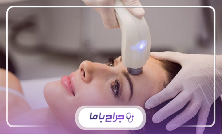 تخصص اپراتور و تأثیر آن بر نتایج لیزر موهای زائد در شهر قدس