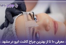 معرفی 10 تا از بهترین جراح کاشت ابرو در مشهد【سال1405】❤️