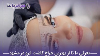 معرفی 10 تا از بهترین جراح کاشت ابرو در مشهد【سال1405】❤️