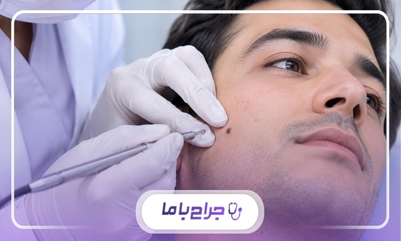چکلیست آمادهسازی کامل برای برداشت خال