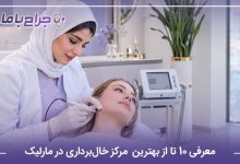 معرفی 10 تا از بهترین مرکز خال‌برداری در مارلیک【سال1405】❤️