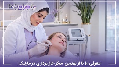 معرفی 10 تا از بهترین مرکز خالبرداری در مارلیک【سال1405】❤️
