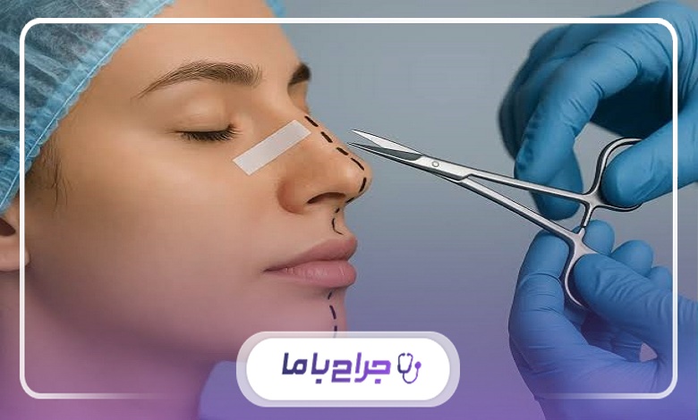 نکات قابل توجه برای انتخاب بهترین جراح بینی استخوانی در کرج