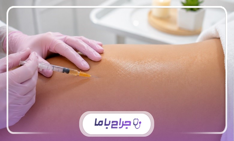 خدمات بهترین دکتر فیلر بادی در کرج