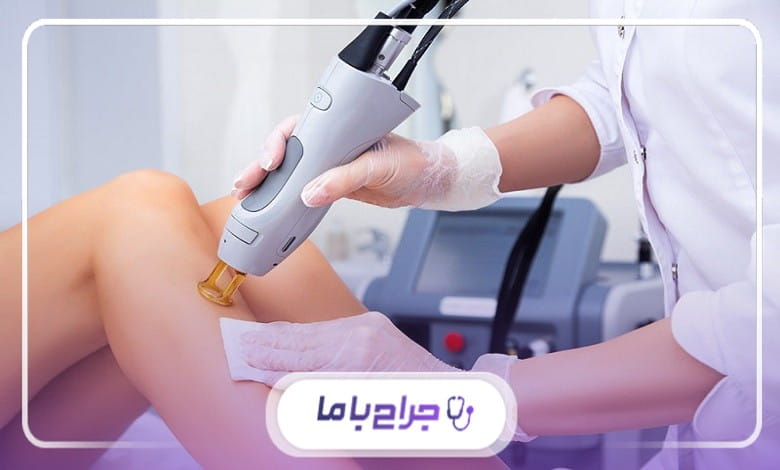 لیزر فول بادی برای چه کسانی مناسب است؟