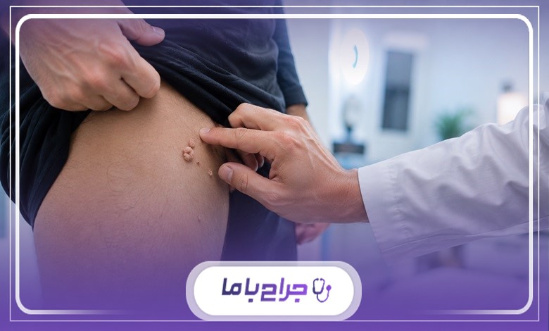 چگونه جراح زگیل تناسلی در مشهد را انتخاب کنیم؟