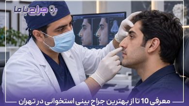 بهترین جراح بینی استخوانی در تهران