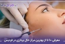 بهترین مرکز خال برداری در فردیس