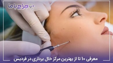 بهترین مرکز خال برداری در فردیس