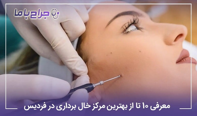 بهترین مرکز خال برداری در فردیس