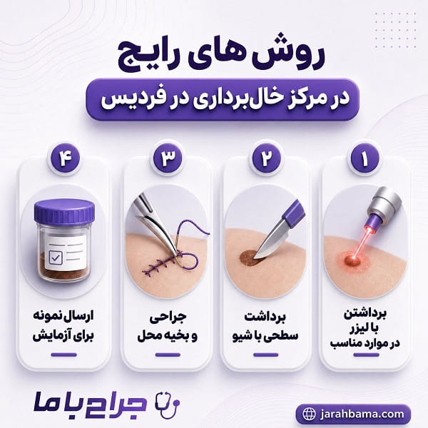 معیارهای مهم در انتخاب مرکز خال برداری