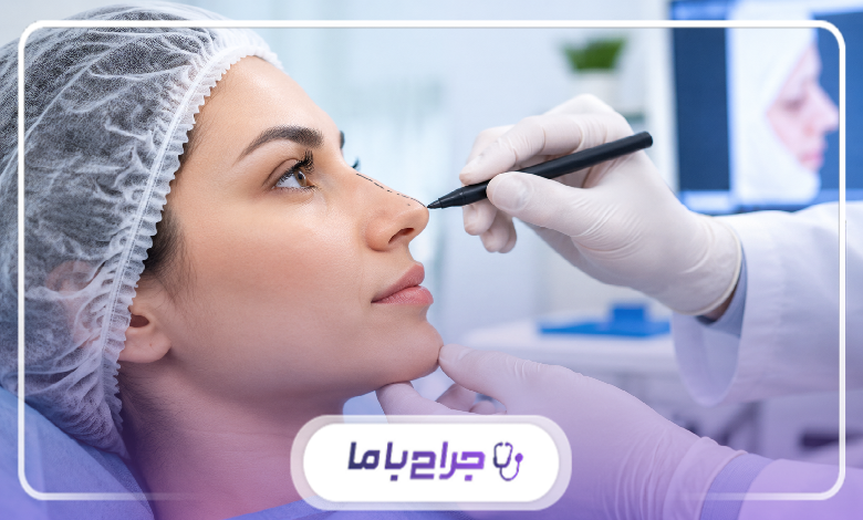 سوالات قبل از عمل بینی