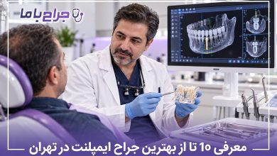 بهترین جراح ایمپلنت در تهران