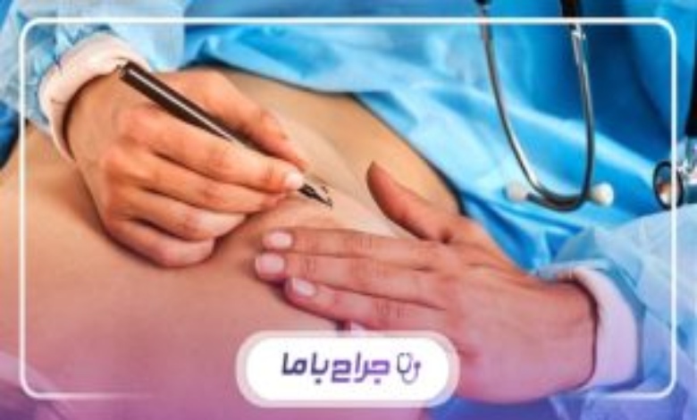 نکات مثبت انجام جراحی توسط بهترین جراح سینه در اهواز